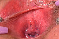 Pussy My Gape Free Membership s1